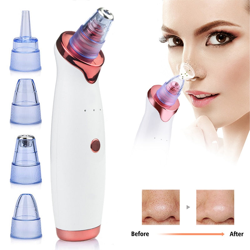 Electric Vacuum Facial Blackhead Remover